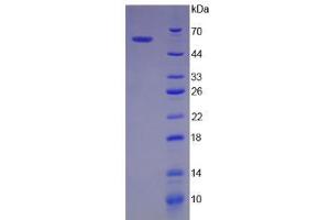 SDS-PAGE analysis of Human BIRC2 Protein. (BIRC2 Protein)