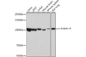 Western blot analysis of extracts of various cell lines, using α-Actinin-4 Rabbit mAb (ABIN7265399) at 1:1000 dilution. (alpha Actinin 4 antibody)