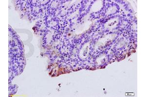 Formalin-fixed and paraffin embedded rat colitis tissue labeled with Anti-CXCR1/IL-8RA Polyclonal Antibody, Unconjugated (ABIN730873) at 1:200, followed by conjugation to the secondary antibody and DAB staining (CXCR1 antibody  (AA 186-280))