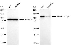 Western blotting analysis using notch receptor 1 antibody (ABIN7799625).