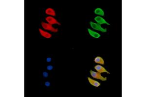 ABIN7095560 and ABIN7099617 staining Hela cells by IF/ICC. (ARPIN antibody)