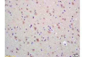 Formalin-fixed and paraffin embedded rat brain labeled with Rabbit Anti HSP60 Polyclonal Antibody, Unconjugated (ABIN726080) at 1:200 followed by conjugation to the secondary antibody and DAB staining (HSPD1 antibody  (AA 501-573))