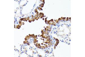 Immunohistochemistry of paraffin-embedded mouse lung using SMYD4 antibody (ABIN6133038, ABIN6148171, ABIN6148172 and ABIN6223147) at dilution of 1:100 (40x lens). (SMYD4 antibody  (AA 1-260))