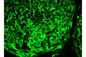 Immunofluorescent staining of human ES cell line. (TRA1-60 antibody)
