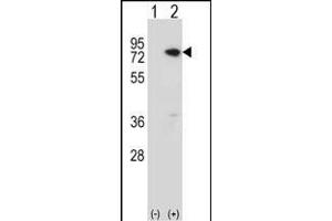 Western blot analysis of MeCP2 (arrow) using rabbit polyclonal MeCP2 Antibody  (ABIN650709 and ABIN2839306).