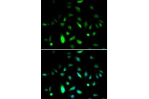 Immunofluorescence analysis of A549 cell using CCNB1 antibody. (Cyclin B1 antibody  (C-Term))