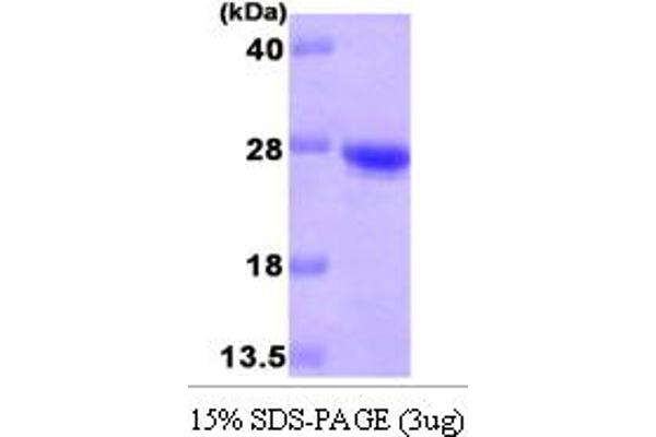 CDO1 Protein (AA 1-170) (His tag)