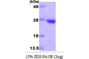 SDS-PAGE (SDS) image for Cysteine Dioxygenase, Type I (CDO1) (AA 1-170) protein (His tag) (ABIN666895)