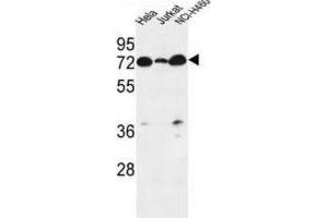 Western Blotting (WB) image for anti-Lipid Phosphate Phosphatase-Related Protein Type 4 (LPPR4) antibody (ABIN3002187) (LPPR4 antibody)
