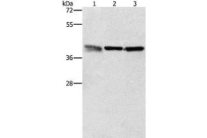 Western Blot analysis of A549, K562 and PC3 cell using ZFP42 Polyclonal Antibody at dilution of 1:500 (ZFP42 antibody)