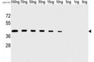Western Blotting (WB) image for anti-Tyr/ser Protein Phosphatase antibody (ABIN2995280) (Tyr/ser Protein Phosphatase antibody)