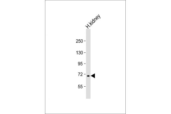 MLL5/KMT2E anticorps  (N-Term)