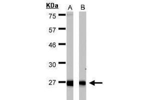 Western Blotting (WB) image for anti-Hydroxysteroid (17-Beta) Dehydrogenase 10 (HSD17B10) (C-Term) antibody (ABIN2854703)
