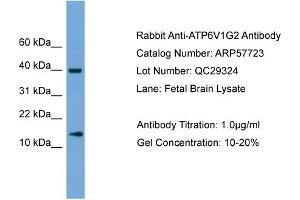 WB Suggested Anti-ATP6V1G2  Antibody Titration: 0.
