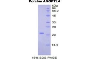 SDS-PAGE analysis of Pig ANGPTL4 Protein. (ANGPTL4 Protein)