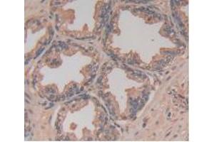DAB staining on IHC-P; Samples: Human Prostate Gland Tissue