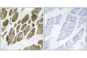 Immunohistochemistry analysis of paraffin-embedded human skeletal muscle tissue, using NMU Antibody. (Neuromedin U antibody  (AA 125-174))