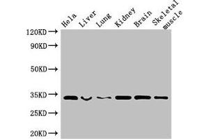 Western Blot Positive WB detected in: Hela whole cell lysate, Mouse liver tissue, Mouse lung tissue, Mouse kidney tissue, Mouse brain tissue, Mouse skeletal muscle tissue All lanes: CNN2 antibody at 2. (CNN2 antibody  (AA 2-309))