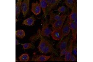 Immunofluorescence staining of methanol-fixed HeLa cells using LC3A /Apg-8 antibody (E021402, Red) (MAP1LC3A antibody)