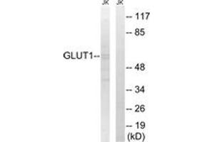 Western blot analysis of extracts from Jurkat cells, using GLUT1 Antibody. (GLUT1 antibody  (AA 441-490))
