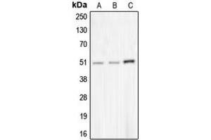 Western blot analysis of CHRNA10 expression in MDAMB453 (A), NCIH292 (B), COLO205 (C) whole cell lysates. (CHRNA10 antibody  (C-Term))