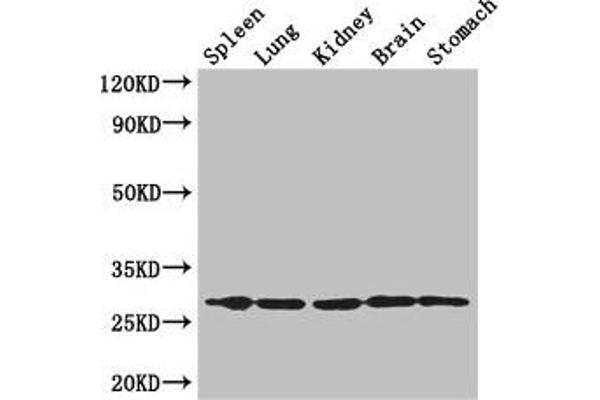 RTP3 antibody  (AA 1-211)