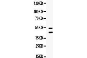 Western blot analysis of EPCR/CD201 expression in A549 whole cell lysates (lane 1). (PROCR antibody  (AA 18-210))