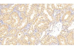 Detection of IK in Human Kidney Tissue using Polyclonal Antibody to IK Cytokine, Down Regulator Of HLA II (IK) (Protein Red (IK) (AA 1-192) antibody)