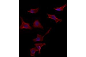 ABIN6265587 and ABIN6272983 staining HepG2 by IF/ICC.