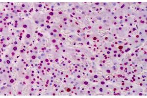 Human Liver: Formalin-Fixed, Paraffin-Embedded (FFPE) (Poly-ADP-Ribose antibody)