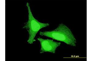 Immunofluorescence of monoclonal antibody to ZAK on HeLa cell. (ZAK antibody  (AA 1-120))