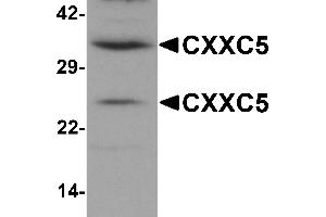 Western Blotting (WB) image for anti-CXXC Finger Protein 5 (CXXC5) (N-Term) antibody (ABIN1031339) (CXXC5 antibody  (N-Term))