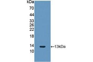 Western Blotting (WB) image for anti-Fibroblast Growth Factor 2 (Basic) (FGF2) antibody (ABIN2929255)