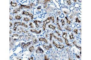 IHC analysis of ATG7 using anti-ATG7 antibody (ABIN7603109). (ATG7 antibody  (N-Term))