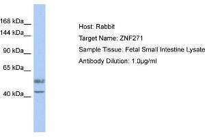 Host: Rabbit Target Name: ZNF271 Sample Type: Fetal Small Intestine lysates Antibody Dilution: 1.
