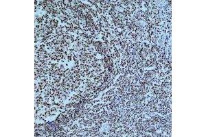 Immunohistochemical analysis of Cleaved PARP1 staining in human tonsil formalin fixed paraffin embedded tissue section.