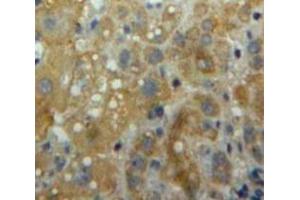 #VALUE! (ITGAL antibody  (AA 809-1066))