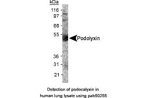 Image no. 1 for anti-Podocalyxin-Like (PODXL) (AA 100-200), (Internal Region) antibody (ABIN363564) (PODXL antibody  (Internal Region))