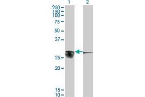 Western Blot analysis of CACYBP expression in transfected 293T cell line by CACYBP monoclonal antibody (M01), clone 2E3. (CACYBP antibody  (AA 1-228))