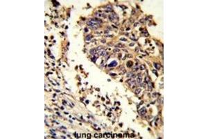 Immunohistochemistry (IHC) image for anti-LUC7-Like (LUC7L) antibody (ABIN3002860) (LUC7L antibody)