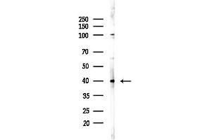 anti-Melanocortin 5 Receptor (MC5R) (C-Term) antibody