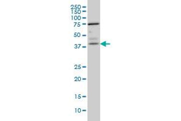 PNMA1 anticorps  (AA 62-160)