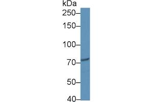 Western blot analysis of Human jurkat cell lysate, using Human CIP2A Antibody (1 µg/ml) and HRP-conjugated Goat Anti-Rabbit antibody ( (KIAA1524 antibody  (AA 230-560))