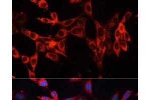 Immunofluorescence analysis of NIH/3T3 cells using SLC29A1 Polyclonal Antibody at dilution of 1:100. (SLC29A1 antibody)
