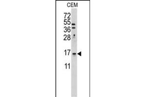Western blot analysis of anti-LSM1 Antibody (C-term) (ABIN389386 and ABIN2839481) in CEM cell line lysates (35 μg/lane). (LSM1 antibody  (C-Term))