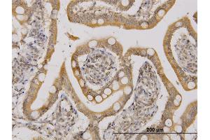 Immunoperoxidase of monoclonal antibody to UBE2D2 on formalin-fixed paraffin-embedded human small Intestine. (UBE2D2 antibody  (AA 1-94))