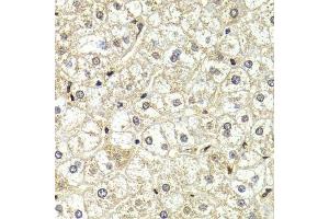 Immunohistochemistry of paraffin-embedded human liver injury using LMNB2 Antibody. (Lamin B2 antibody  (AA 341-620))