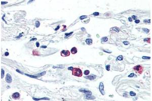 Anti-LGR6 antibody  ABIN1049008 IHC staining of human neutrophils. (LGR6 antibody  (Internal Region))