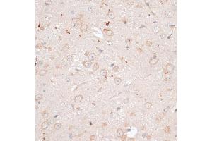 Immunohistochemistry (IHC) image for anti-ATP-Binding Cassette, Sub-Family B (MDR/TAP), Member 7 (ABCB7) (AA 503-753) antibody (ABIN7265735)