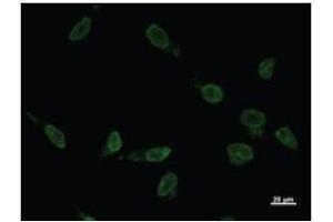 Immunostaining analysis in HeLa cells. (VAX2 antibody)